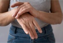 Lepra: una enfermedad curable que aún hoy se diagnostica tarde por desconociemiento y estigma